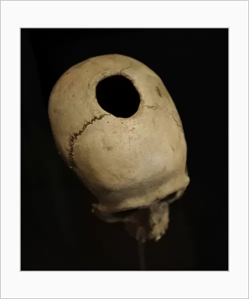 Trepanned skull. Neolithic Period. Denmark