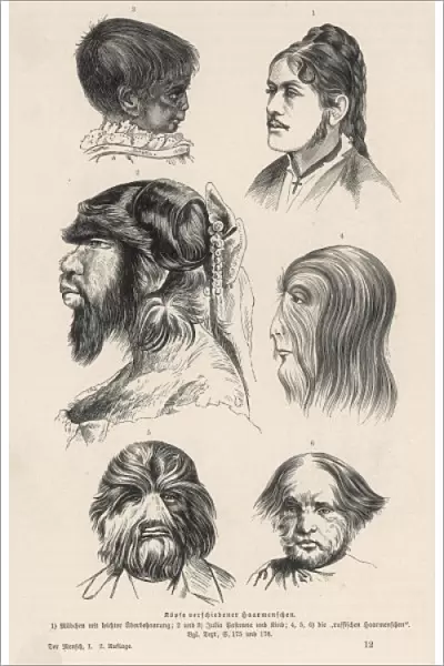 Hairy-Faced Women