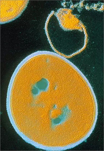 False-colour TEM of Staphylococcus aureus