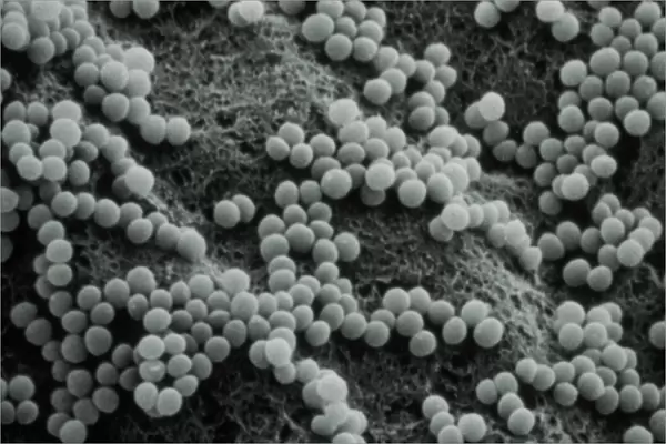False-col TEM of Staphylococcus aureus