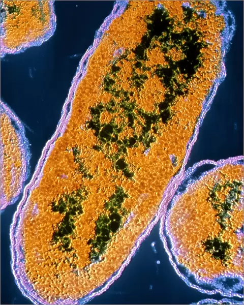 False-colour TEM of E. coli bacteria