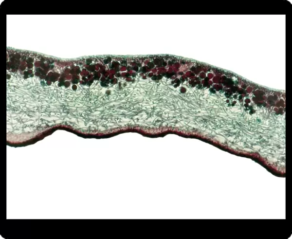 Lichen, light micrograph