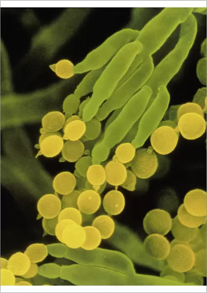 SEM of penicillin fungus