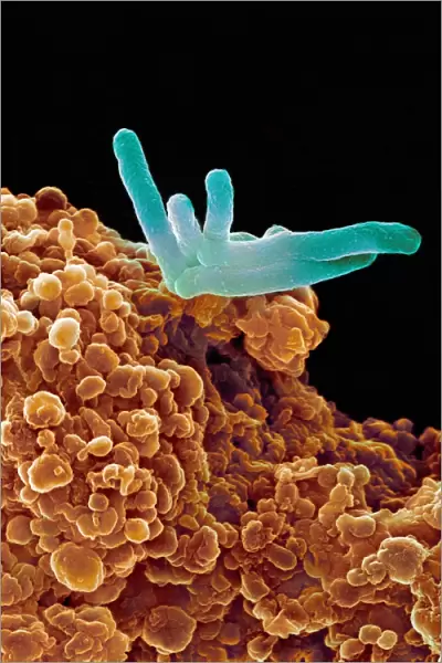 Bacteria infecting a macrophage, SEM