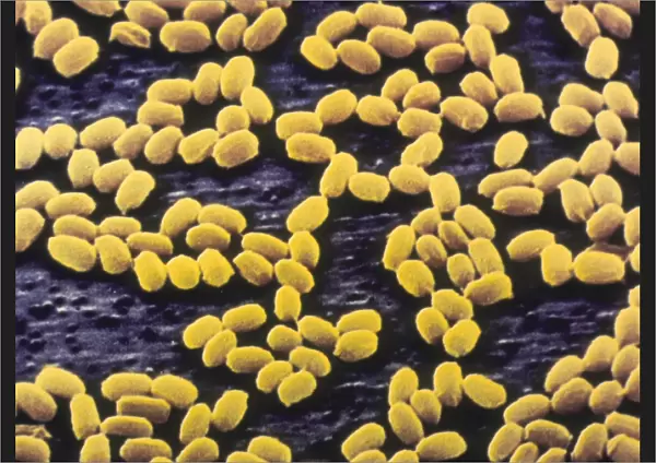 Anthrax bacteria spores