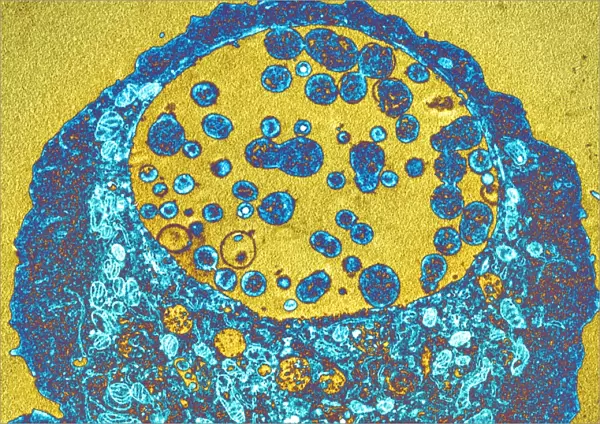 Chlamydia bacteria, TEM