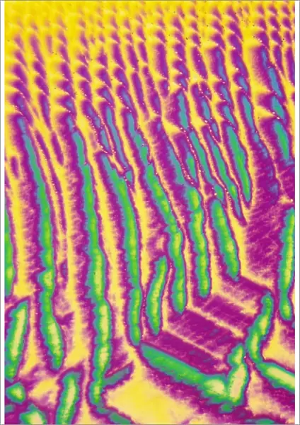 GABA crystals, light micrograph