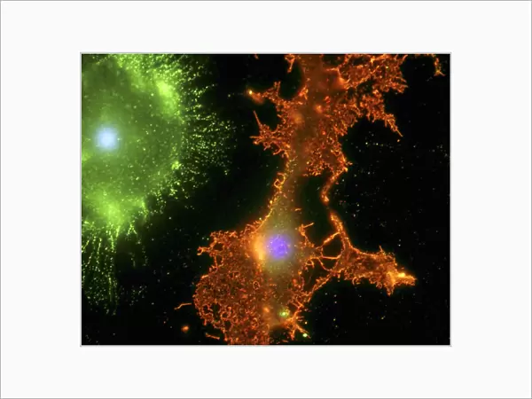 Brain cells in culture, light micrograph
