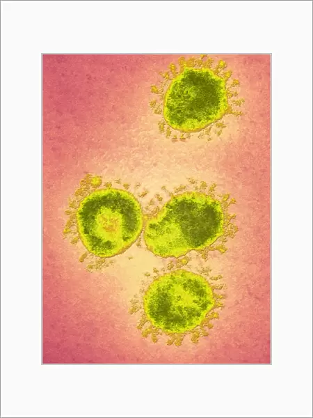 Infectious bronchitis virus (IBV), TEM