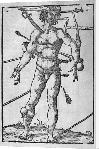 Combat injuries, 16th century