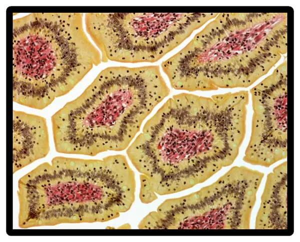 Intestinal villi, light micrograph