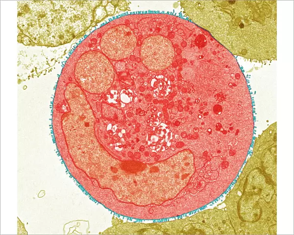 Vesicular stomatitis virus, TEM
