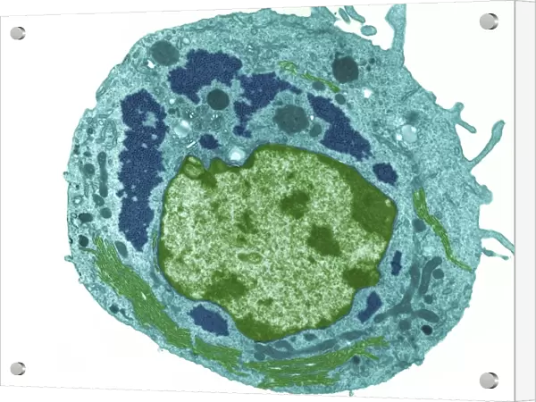 Reovirus particles in a cell, TEM