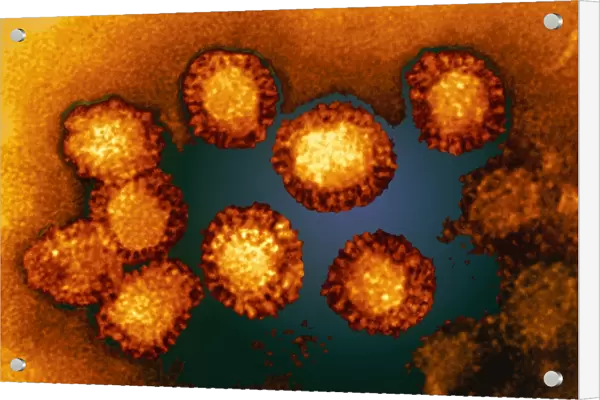 West Nile viruses