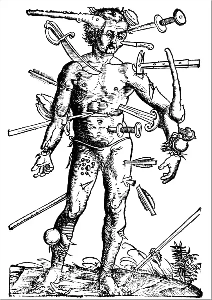 16th century woodcut of a woundman