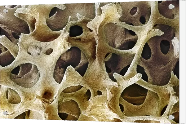 Bone tissue, SEM