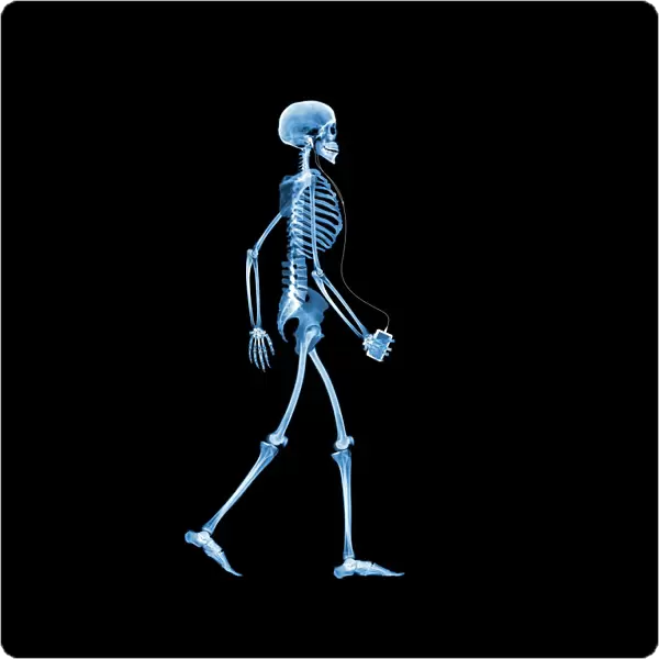Skeleton drinking, X-ray
