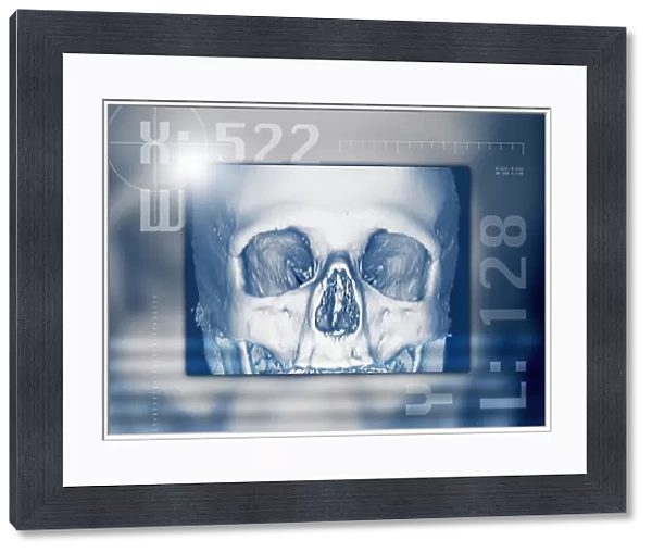Skull, 3-D CT scan
