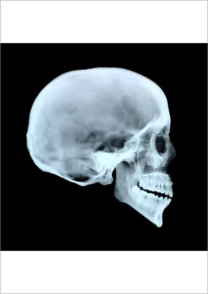 Adult human skull