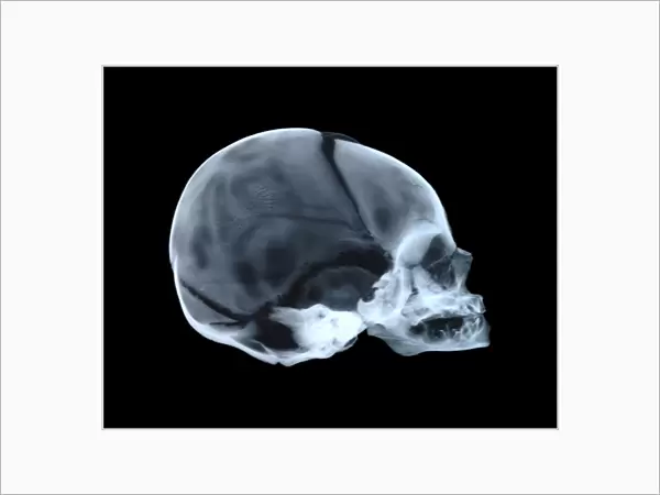 Babys skull