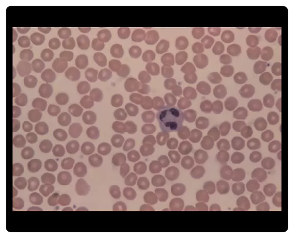 LM of human blood smear showing red & white cells