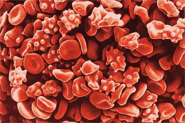 Coloured SEM of red blood cells (erythrocytes)