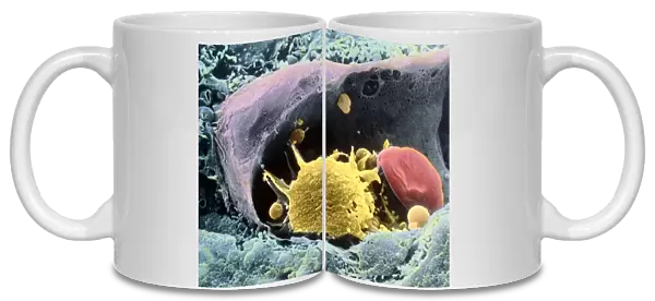Coloured SEM of a monocyte in a blood capillary