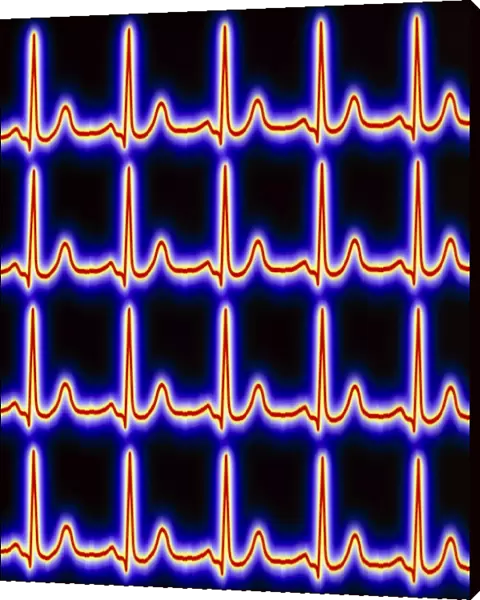 Artwork of healthy ECG traces of the heart