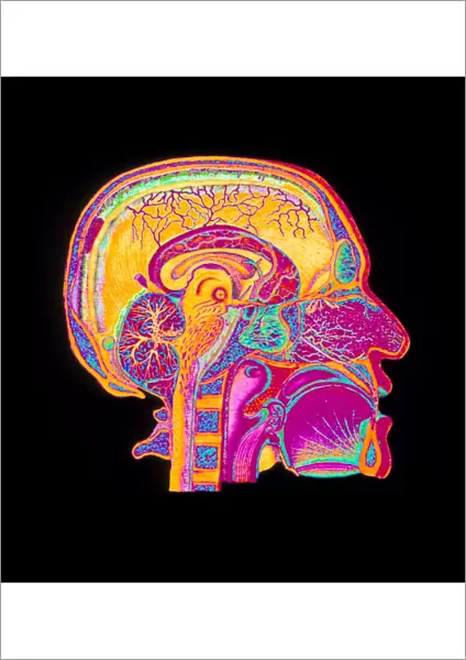 Coloured illustration of sectioned brain in head