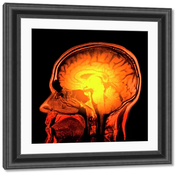 Brain anatomy, MRI scan