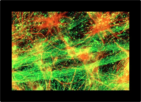 Immunofluorescent LM of neurons & astrocytes