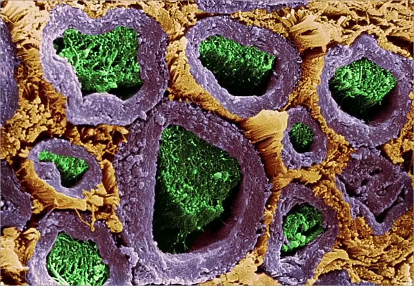 Coloured SEM of a section through nerve fibres