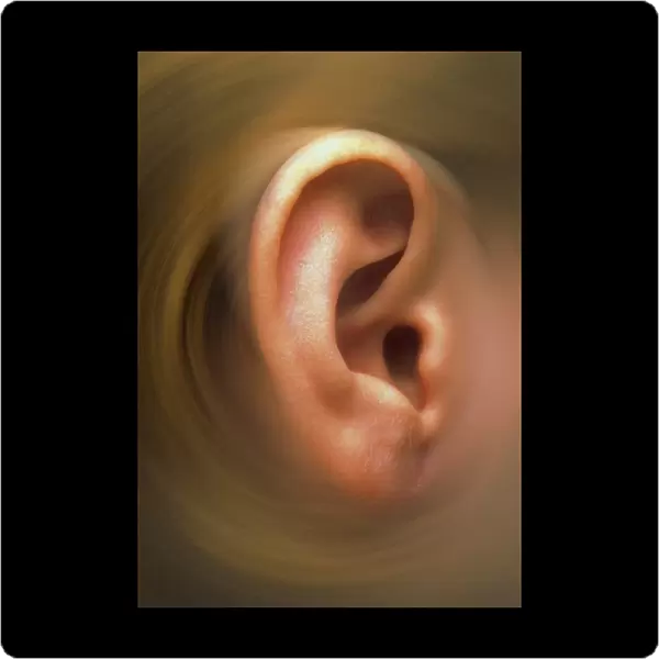 Swirling effect around ear pinna of a child