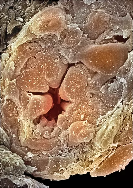 Collecting duct from a kidney, SEM
