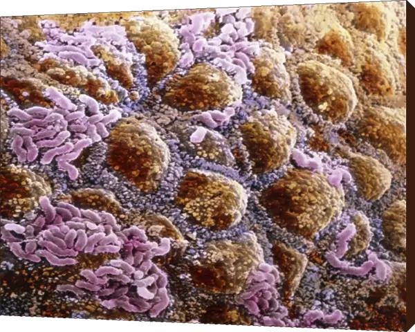False-colour SEM of wall of colon, with bacteria