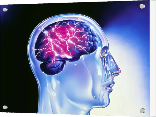 Artwork of epilepsy seen as lightning in brain
