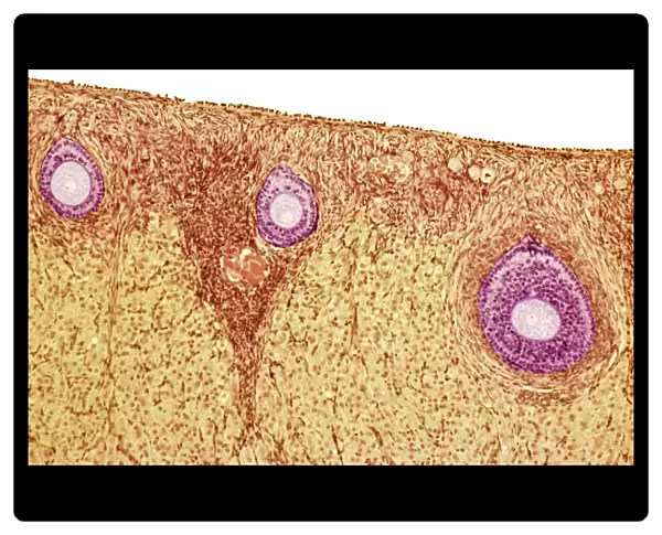 Ovarian follicles, light micrograph