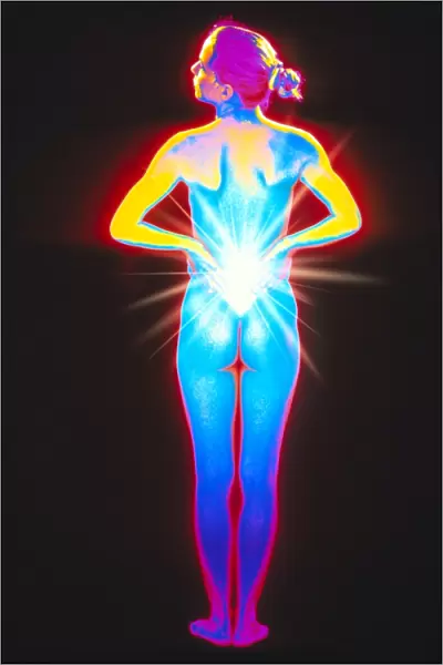 Artwork depicting back pain in a woman