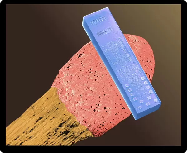 Coloured SEM of blood pressure monitor on a match