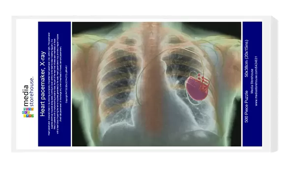 Heart pacemaker, X-ray