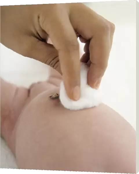 Cleaning umbilical cord stump