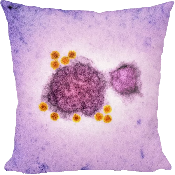 Parvovirus particles, TEM