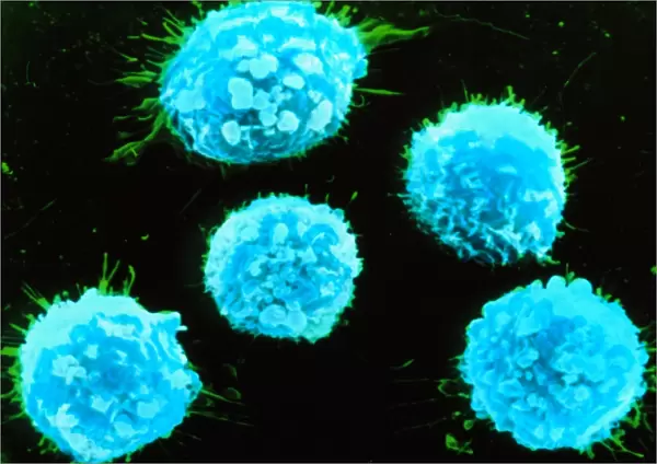 Coloured SEM of B-lymphocyte white blood cells