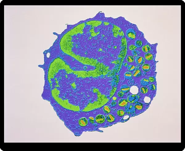 Coloured TEM of a section through an eosinophil