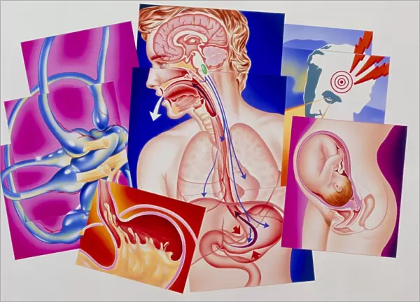 Artwork of vomiting reflex & causes of nausea