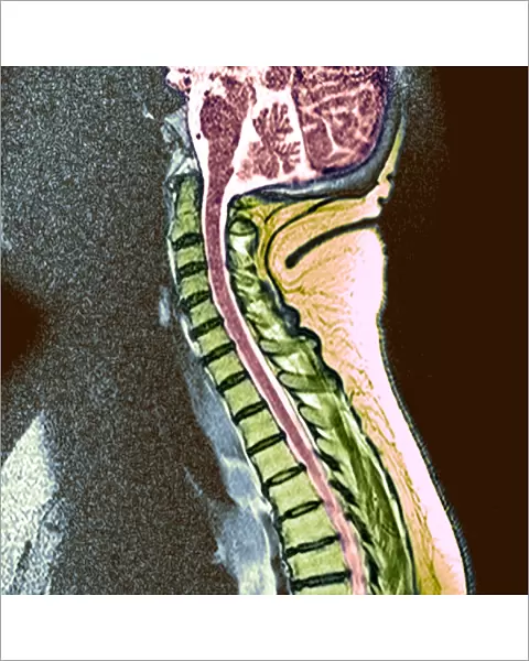 Healthy spine