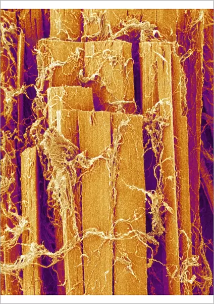 Skeletal muscle fibre