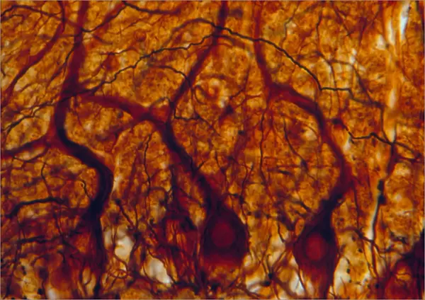 LM of purkinje nerve cells in the cerebellum