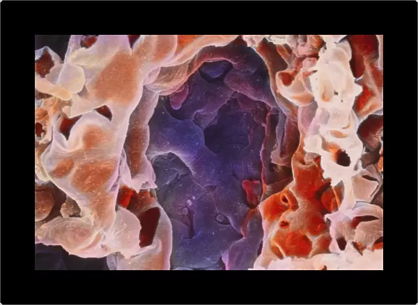 Alveolus in human lung