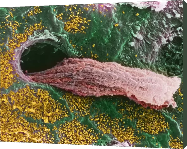 Coloured SEM of a secreting uterine gland
